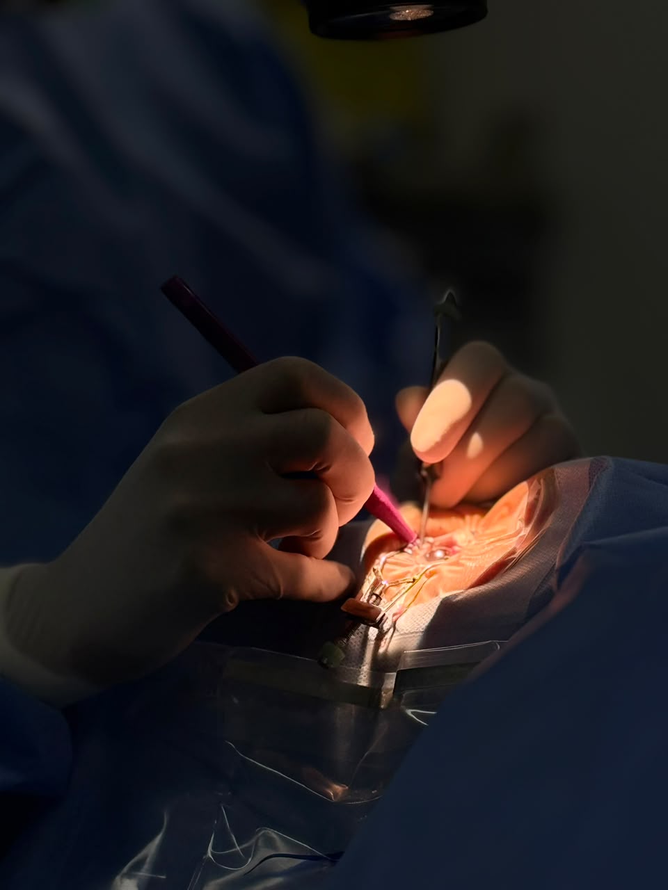 Detalhe de cirurgia oftalmológica
